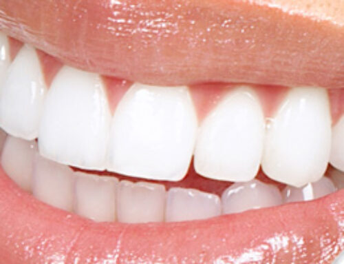 Get a Picture Perfect Smile with Teeth Whitening