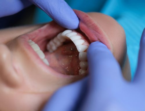 Recognizing Gum Disease Early with a Family Dentist in Flower Mound
